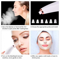 Pormasksug / porrengörare / porsugare / ansiktsrengörare + microdermabrasion